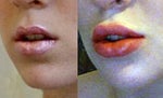 Before/After